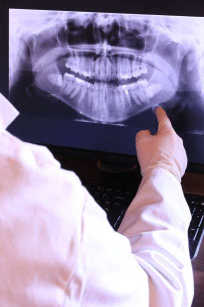 Best Emergency Broken Tooth Repair in St Bonifacius, MN